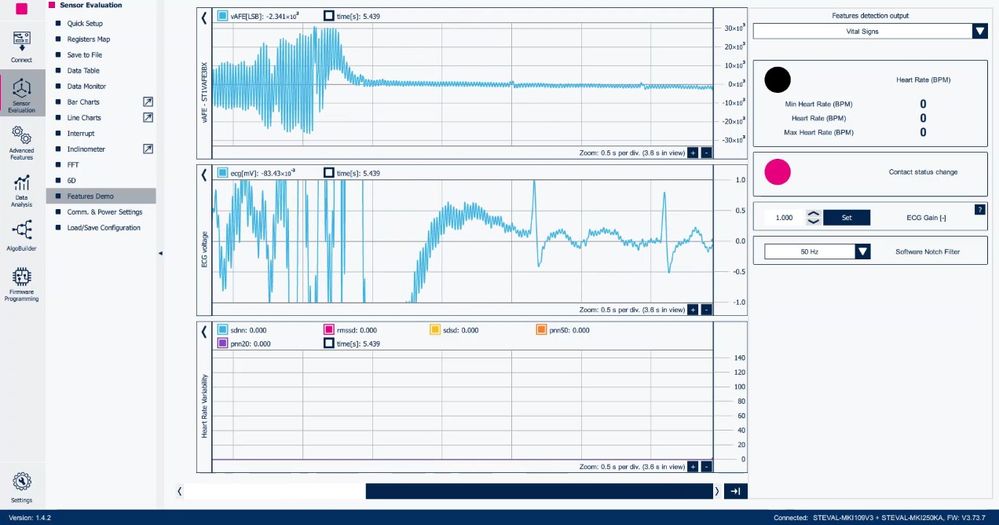 Figure 5: MEMS Studio - Features Demo, Vital Signs