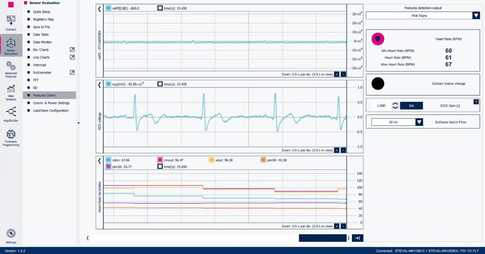 Figure 5: MEMS Studio - Features Demo, Vital Signs