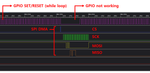 spi dma.PNG