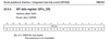 _legacyfs_online_stmicro_images_0693W00000blENLQA2.png